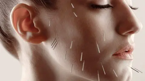 Benefits of Cosmetic Facial Acupuncture